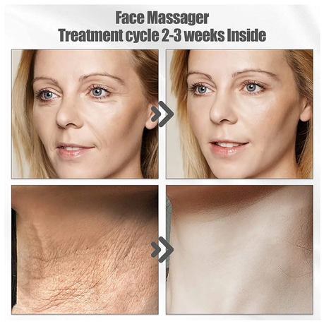 Face & Neck Massaging EMS Anti Aging & Skin Rejuvenation 4 Modes Switching - View 4